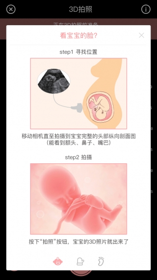 胎儿相机 1.0.7 截图2