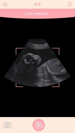 胎儿相机 1.0.7 截图5