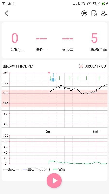 十月宝贝胎心监护医生v1.6.2  截图1