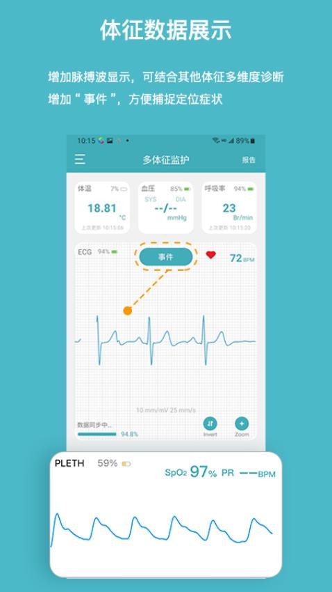 多体征监护app 截图2