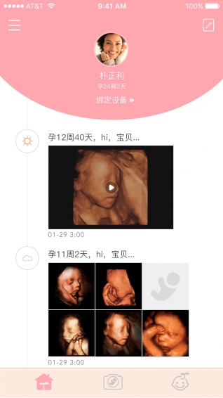 胎儿相机 1.0.7 截图1