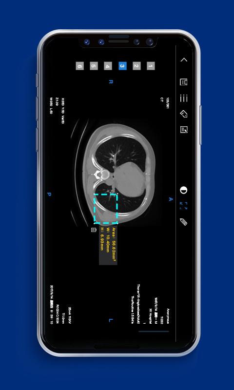 Dicomlabel医疗影像云标注平台App 截图3