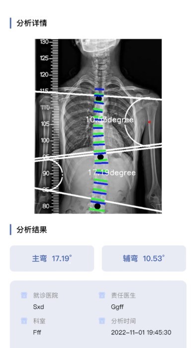 cobb角测量分析平台 截图4