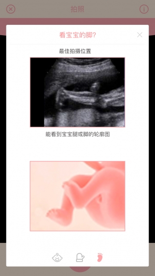 胎儿相机 1.0.7 截图3